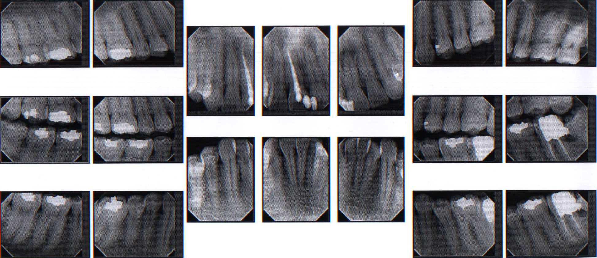 dental radiology fmx